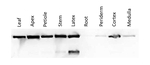 Linamarase Antibody in Western Blot (WB)