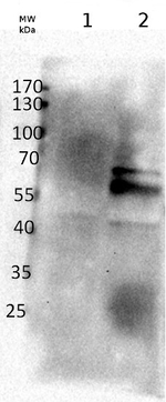BAM1/Beta amylase 1 (chloroplastic) Polyclonal Antibody
