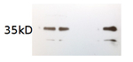 APX1/Ascorbate peroxidase (algal) Polyclonal Antibody