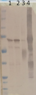 PGM1/Phosphoglucomutase (cytoplasmic 1) Polyclonal Antibody