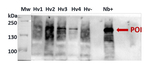 Cas9/CRISPR-associated endonuclease 9 Antibody in Western Blot (WB)