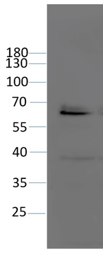 PARP2/Poly (ADP-ribose) polymerase 2 Antibody in Western Blot (WB)