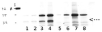 PPH1/TAP38/Protein phosphatase 1 Polyclonal Antibody