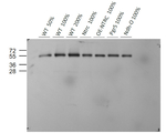 STN7, Serine/threonine-protein kinase STN7 (chloroplastic) Polyclonal Antibody