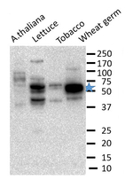 eIF5/Eukaryotic initiation factor eIF5 Antibody in Western Blot (WB)