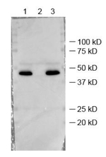 FBPase1/Fructose-1,6-bisphosphatase 1, chloroplastic Polyclonal Antibody