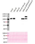 V-ATPase, a3/vacuolar H-ATPase subunit a isoform 3 Polyclonal Antibody
