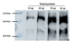 RPB2/DNA-directed RNA polymerase II subunit 2 Antibody in Western Blot (WB)