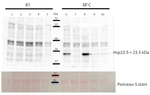 HSP23.5/ Heat shock protein 23.5 (mitochondrial) Antibody in Western Blot (WB)