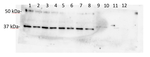 AOX2/Plant alternative oxidase 2 Antibody in Western Blot (WB)