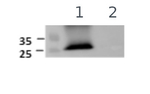 PIP1-1, PIP1-2, PIP1-3, PIP1-4, PIP1-5/Aquaporins Polyclonal Antibody