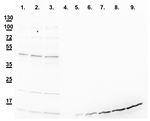 CSD1/Cu/Zn superoxide dismutase 1 (cytosolic) Polyclonal Antibody