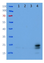 L22/50S ribosomal protein L22 (chloroplastic) Polyclonal Antibody