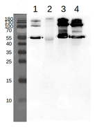 SHMT1/Serine hydroxymethyltransferase 1, mitochondrial Antibody in Western Blot (WB)