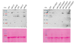 PFK1-7/Phosphofructokinase 1-7 Polyclonal Antibody