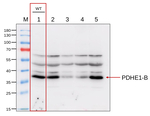 PDHE1-B/Pyruvate dehydrogenase E1 component subunit beta-1, mitochondrial Antibody in Western Blot (WB)