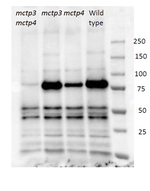 FTIP3/FTIP4/FT Interacting Protein 3/4 Polyclonal Antibody