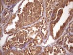 ASB2 Antibody in Immunohistochemistry (Paraffin) (IHC (P))