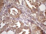 ASB2 Antibody in Immunohistochemistry (Paraffin) (IHC (P))
