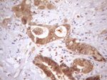 ASB2 Antibody in Immunohistochemistry (Paraffin) (IHC (P))