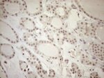 ASB2 Antibody in Immunohistochemistry (Paraffin) (IHC (P))