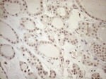 ASB2 Antibody in Immunohistochemistry (Paraffin) (IHC (P))