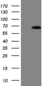 ASB2 Antibody in Western Blot (WB)