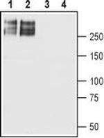 SCN2A (NaV1.2) Polyclonal Antibody