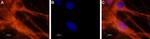 NaV1.6 (SCN8A) Polyclonal Antibody