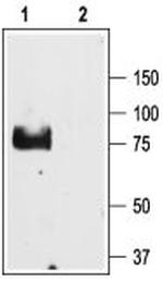 ENaC gamma (SCNN1G) (extracellular) Polyclonal Antibody