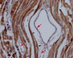 NaV1.5 (SCN5A) (1978-2016) Polyclonal Antibody