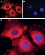 ASIC1 Polyclonal Antibody