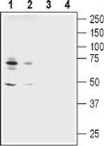 ASIC1 Antibody in Western Blot (WB)