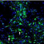 ASIC3 Polyclonal Antibody