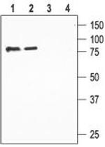 ENaC beta (SCNN1B) (extracellular) Polyclonal Antibody