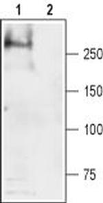 SCN4A (NaV1.4) Polyclonal Antibody