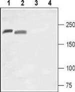 NaV1.8 (SCN10A) (extracellular) Polyclonal Antibody