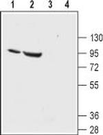 ENaC alpha (SCNN1A) (extracellular) Antibody in Western Blot (WB)