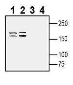 NaV1.5 (SCN5A) (extracellular) Antibody in Western Blot (WB)