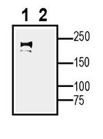 NaV1.5 (SCN5A) (extracellular) Antibody in Western Blot (WB)