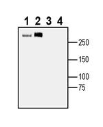 SCN7A (NaX) Antibody in Western Blot (WB)