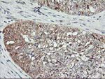 ASCC1 Antibody in Immunohistochemistry (Paraffin) (IHC (P))