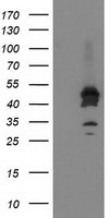 ASCC1 Antibody in Western Blot (WB)
