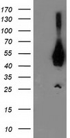 ASCC1 Antibody in Western Blot (WB)