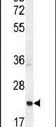 ASCL2 Antibody in Western Blot (WB)