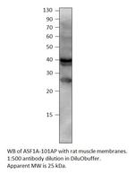 ASF1A Polyclonal Antibody