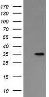 ASGR2 Antibody in Western Blot (WB)