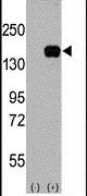 ASK1 Antibody in Western Blot (WB)