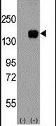 ASK1 Antibody in Western Blot (WB)