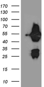ASL Antibody in Western Blot (WB)
